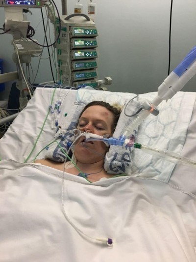 Laura Summers in the Intensive Care Unit - 2018